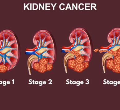Kidney Cancer Specialist in India - Dr Dushyant Nadar