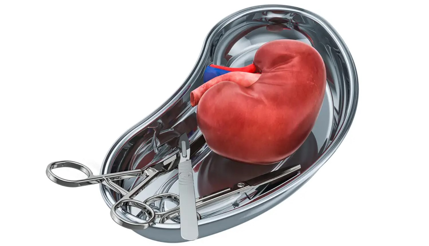 Kidney Transplant in India - Dr Dushyant Nadar