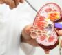 Renal Transplant in Noida Best Kidney Transplant Specialist 90x80