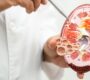 Renal Transplant in Noida Best Kidney Transplant Specialist e1759742683884 90x80